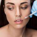 Lip fillers reduce perioral wrinkles caused by stress